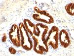 Cytokeratin 18 (KRT18) Antibody in Immunohistochemistry (Paraffin) (IHC (P))