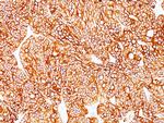 Cytokeratin 18 (KRT18) Antibody in Immunohistochemistry (Paraffin) (IHC (P))