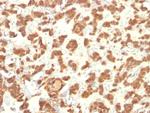 Cytokeratin 18 (KRT18) Antibody in Immunohistochemistry (Paraffin) (IHC (P))