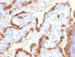 Cytokeratin 18 (KRT18) Antibody in Immunohistochemistry (Paraffin) (IHC (P))