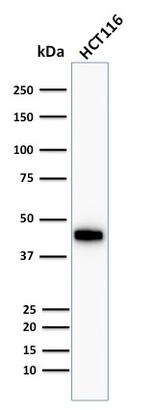 Cytokeratin 18 (KRT18) Antibody in Western Blot (WB)