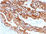 Cytokeratin 18 (KRT18) Antibody in Immunohistochemistry (Paraffin) (IHC (P))