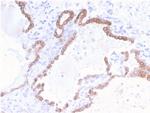 Cytokeratin 18 (KRT18) Antibody in Immunohistochemistry (Paraffin) (IHC (P))