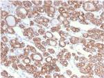 Cytokeratin 18 (KRT18) Antibody in Immunohistochemistry (Paraffin) (IHC (P))