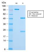 Cytokeratin 18 (KRT18) Antibody in SDS-PAGE (SDS-PAGE)