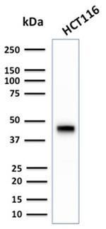 Cytokeratin 18 (KRT18) Antibody in Western Blot (WB)