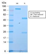 Cytokeratin 18 (KRT18) Antibody in SDS-PAGE (SDS-PAGE)