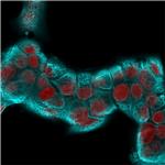 Cytokeratin 18 (KRT18) Antibody in Immunocytochemistry (ICC/IF)