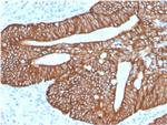 Cytokeratin 18 (KRT18) Antibody in Immunohistochemistry (Paraffin) (IHC (P))