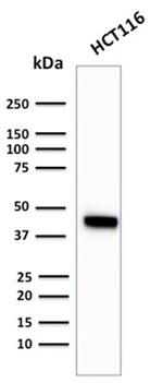 Cytokeratin 18 (KRT18) Antibody in Western Blot (WB)