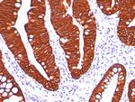 Cytokeratin 19 (KRT19) (Pancreatic Stem Cell Marker) Antibody in Immunohistochemistry (Paraffin) (IHC (P))