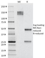 Cytokeratin 19 (KRT19) (Pancreatic Stem Cell Marker) Antibody in SDS-PAGE (SDS-PAGE)