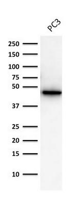 Cytokeratin 19 (KRT19) (Pancreatic Stem Cell Marker) Antibody in Western Blot (WB)