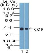 Cytokeratin 19 (KRT19) (Pancreatic Stem Cell Marker) Antibody in Western Blot (WB)