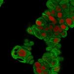 Cytokeratin 19 (KRT19) (Pancreatic Stem Cell Marker) Antibody in Immunocytochemistry (ICC/IF)