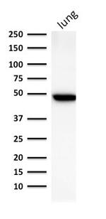 Cytokeratin 19 (KRT19) (Pancreatic Stem Cell Marker) Antibody in Western Blot (WB)