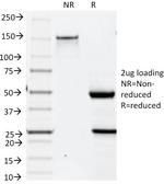 Cytokeratin 19 (KRT19) (Pancreatic Stem Cell Marker) Antibody in SDS-PAGE (SDS-PAGE)