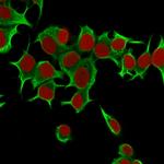 Cytokeratin 19 (KRT19) (Pancreatic Stem Cell Marker) Antibody in Immunocytochemistry (ICC/IF)