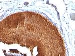 Cytokeratin 19 (KRT19) (Pancreatic Stem Cell Marker) Antibody in Immunohistochemistry (Paraffin) (IHC (P))