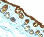 Cytokeratin 19 (Pancreatic Stem Cell Marker) Antibody in Immunohistochemistry (Paraffin) (IHC (P))