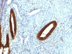 Cytokeratin 19 (Pancreatic Stem Cell Marker) Antibody in Immunohistochemistry (Paraffin) (IHC (P))