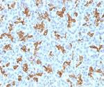 Cytokeratin 19 (Pancreatic Stem Cell Marker) Antibody in Immunohistochemistry (Paraffin) (IHC (P))