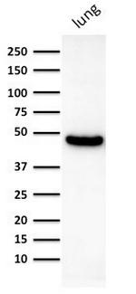 Cytokeratin 19 (Pancreatic Stem Cell Marker) Antibody in Western Blot (WB)