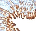 Cytokeratin 19 (Pancreatic Stem Cell Marker) Antibody in Immunohistochemistry (Paraffin) (IHC (P))