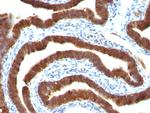 Cytokeratin 19 (KRT19) (Pancreatic Stem Cell Marker) Antibody in Immunohistochemistry (Paraffin) (IHC (P))