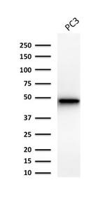 Cytokeratin 19 (KRT19) (Pancreatic Stem Cell Marker) Antibody in Western Blot (WB)