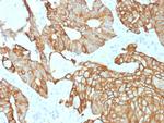 Cytokeratin 19 (KRT19) Antibody in Immunohistochemistry (Paraffin) (IHC (P))