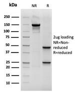 Cytokeratin 19 (KRT19) Antibody in SDS-PAGE (SDS-PAGE)