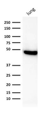 Cytokeratin 19 (KRT19) Antibody in Western Blot (WB)