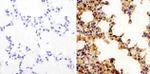 Claudin 18 Antibody in Immunohistochemistry (Paraffin) (IHC (P))