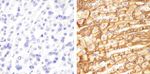 Claudin 18 Antibody in Immunohistochemistry (Paraffin) (IHC (P))