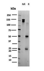 BOLA3 (Transcription Factor) Antibody in SDS-PAGE (SDS-PAGE)