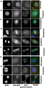 Aurora C Antibody in Immunocytochemistry (ICC/IF)