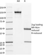 CD171/NCAM-L1 (Axonal Marker) Antibody in SDS-PAGE (SDS-PAGE)