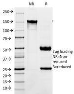 CD171/NCAM-L1 (L1 Cell Adhesion Molecule) Antibody in SDS-PAGE (SDS-PAGE)