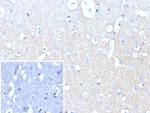 CD171/NCAM-L1 (L1 Cell Adhesion Molecule) Antibody in Immunohistochemistry (Paraffin) (IHC (P))