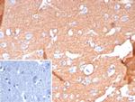 CD171/NCAM-L1 (L1 Cell Adhesion Molecule) Antibody in Immunohistochemistry (Paraffin) (IHC (P))