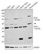 MTA1 Antibody in Western Blot (WB)