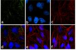 PPAP2B Antibody in Immunocytochemistry (ICC/IF)