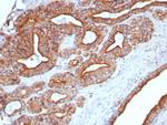 CD107a/Lysosomal associated membrane protein 1 (LAMP1) Antibody in Immunohistochemistry (Paraffin) (IHC (P))