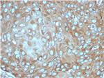 Laminin Receptor/ RPSA (Marker of Metastatic Potential) Antibody in Immunohistochemistry (Paraffin) (IHC (P))