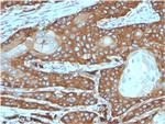 Laminin Receptor/ RPSA (Marker of Metastatic Potential) Antibody in Immunohistochemistry (Paraffin) (IHC (P))