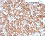 Laminin Receptor/ RPSA (Marker of Metastatic Potential) Antibody in Immunohistochemistry (Paraffin) (IHC (P))