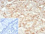 Stathmin 1/STMN1 Antibody in Immunohistochemistry (Paraffin) (IHC (P))