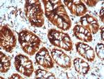 Stathmin 1/STMN1 Antibody in Immunohistochemistry (Paraffin) (IHC (P))