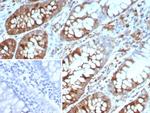 Stathmin 1/STMN1 Antibody in Immunohistochemistry (Paraffin) (IHC (P))